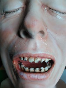 Rotten teeth in fibreglass display head