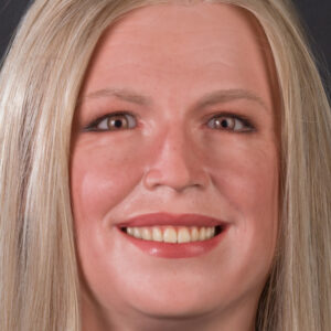 Prosthetic teeth in silicone heads