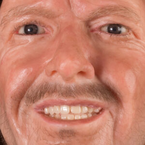 Prosthetic teeth in silicone heads