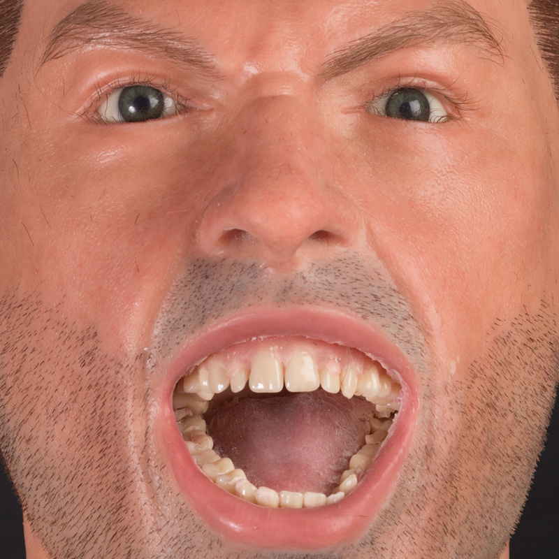 Prosthetic teeth in silicone heads