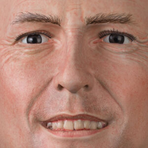 Prothetische Zähne im Polyesterkopf